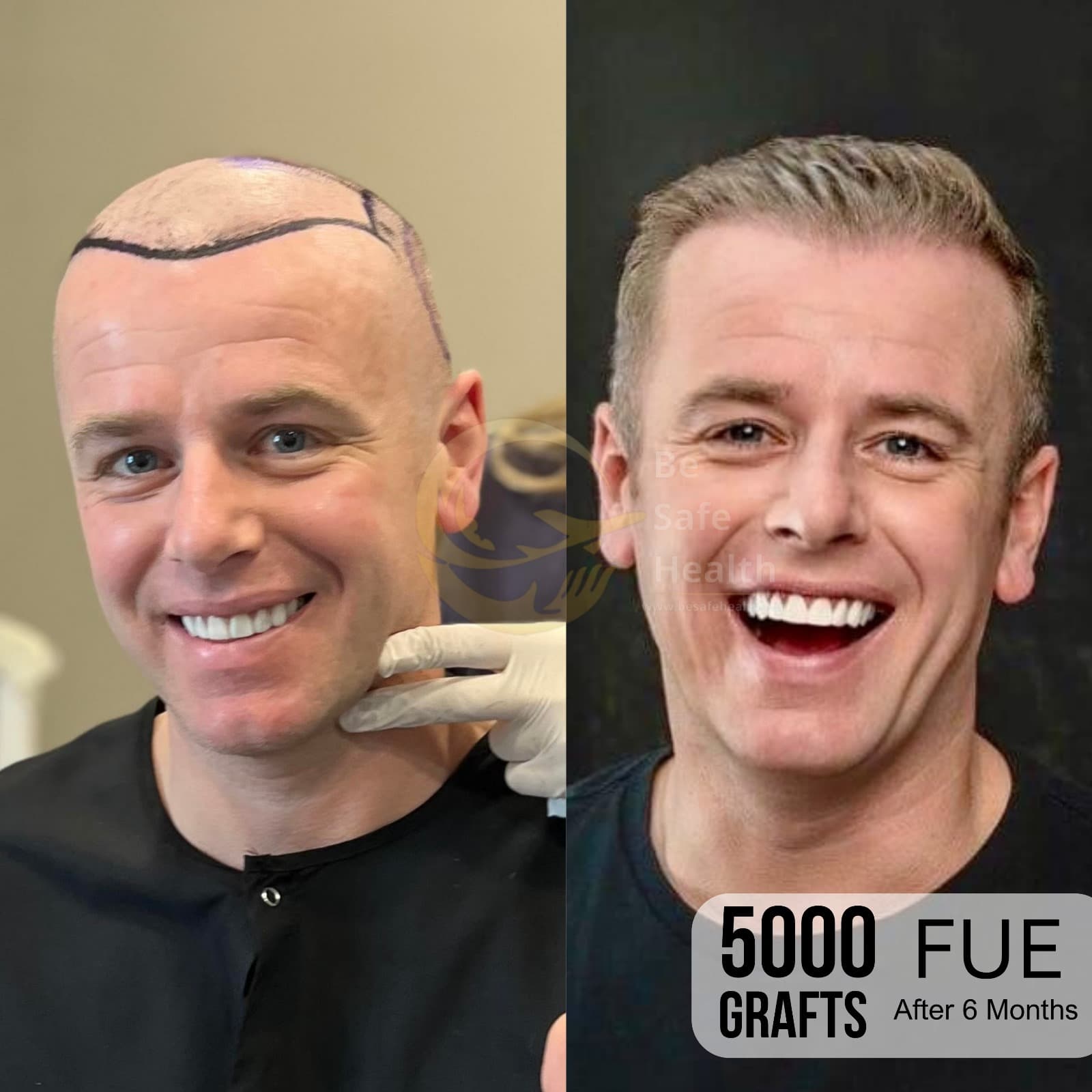 Case 1 - Before & After