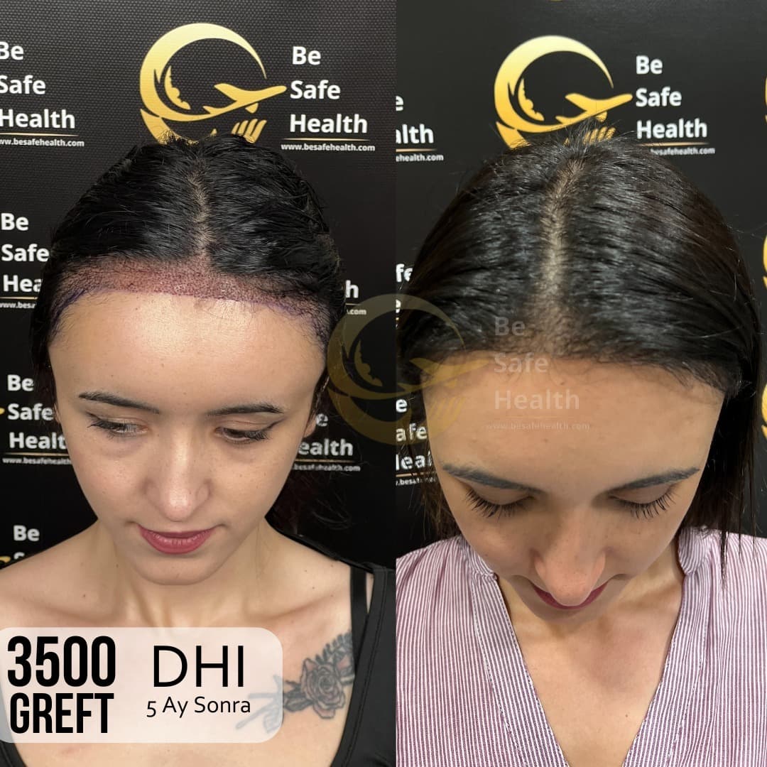 Case 4 - Before & After
