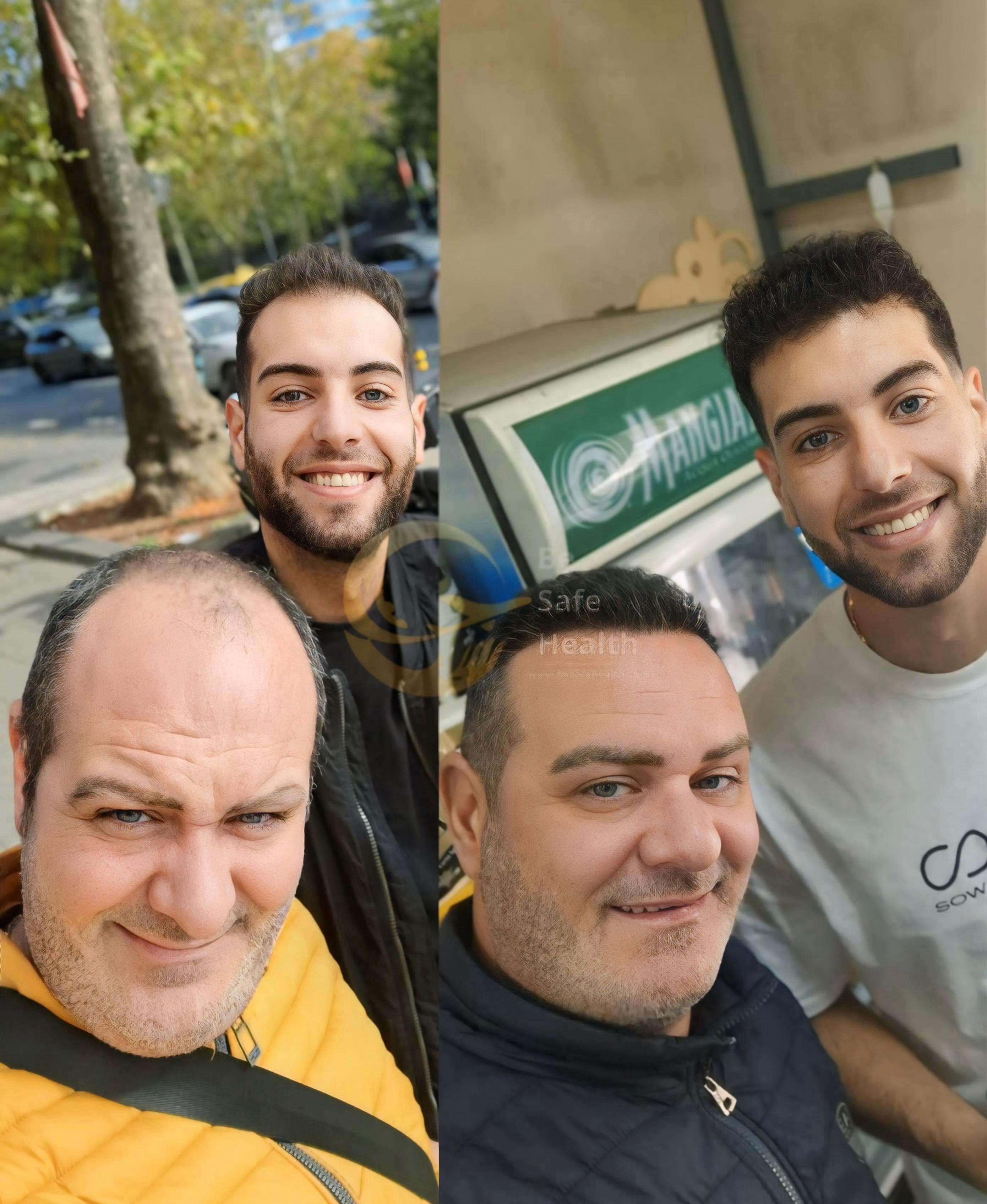 Case 5 - Before & After