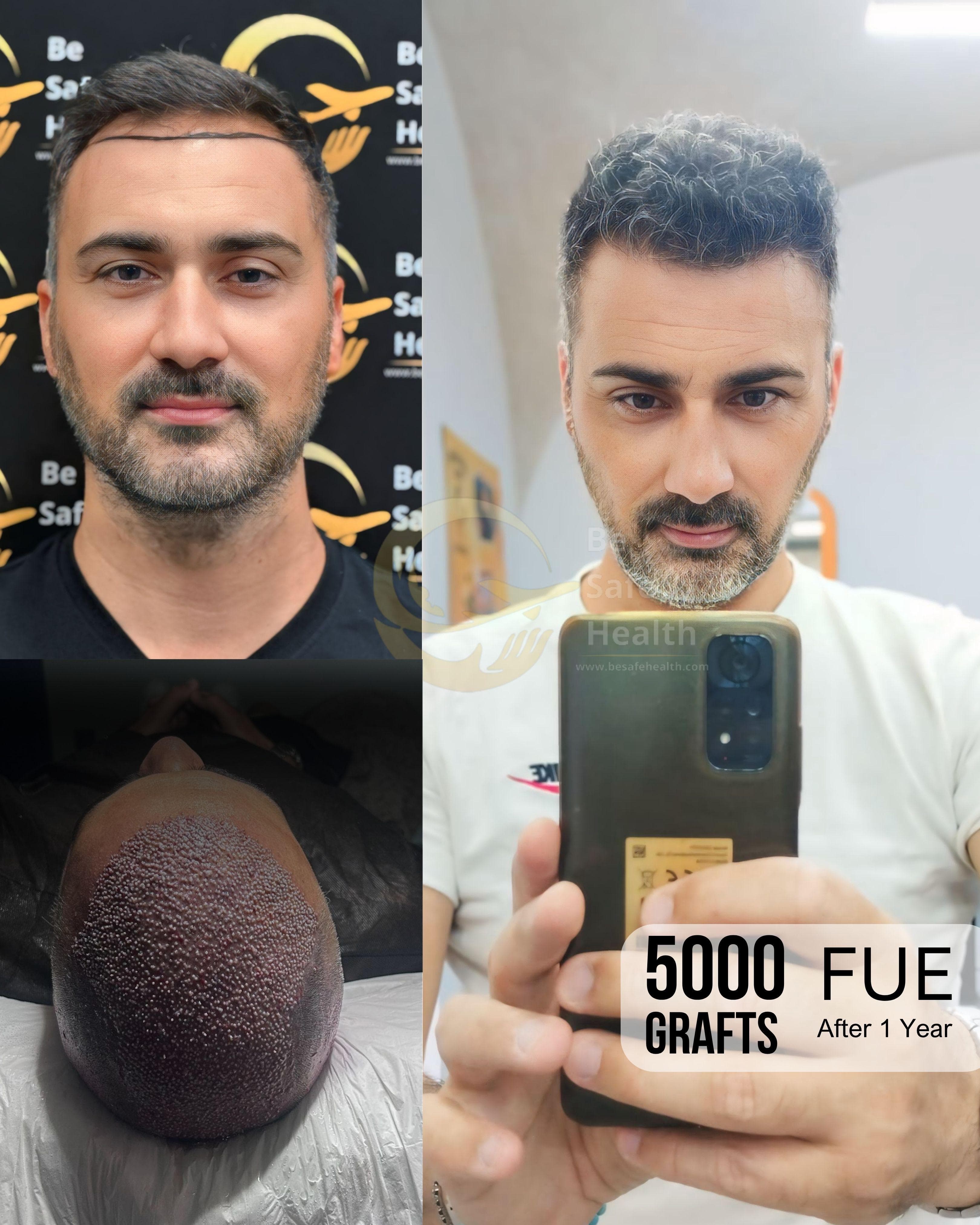 Case 6 - Before & After