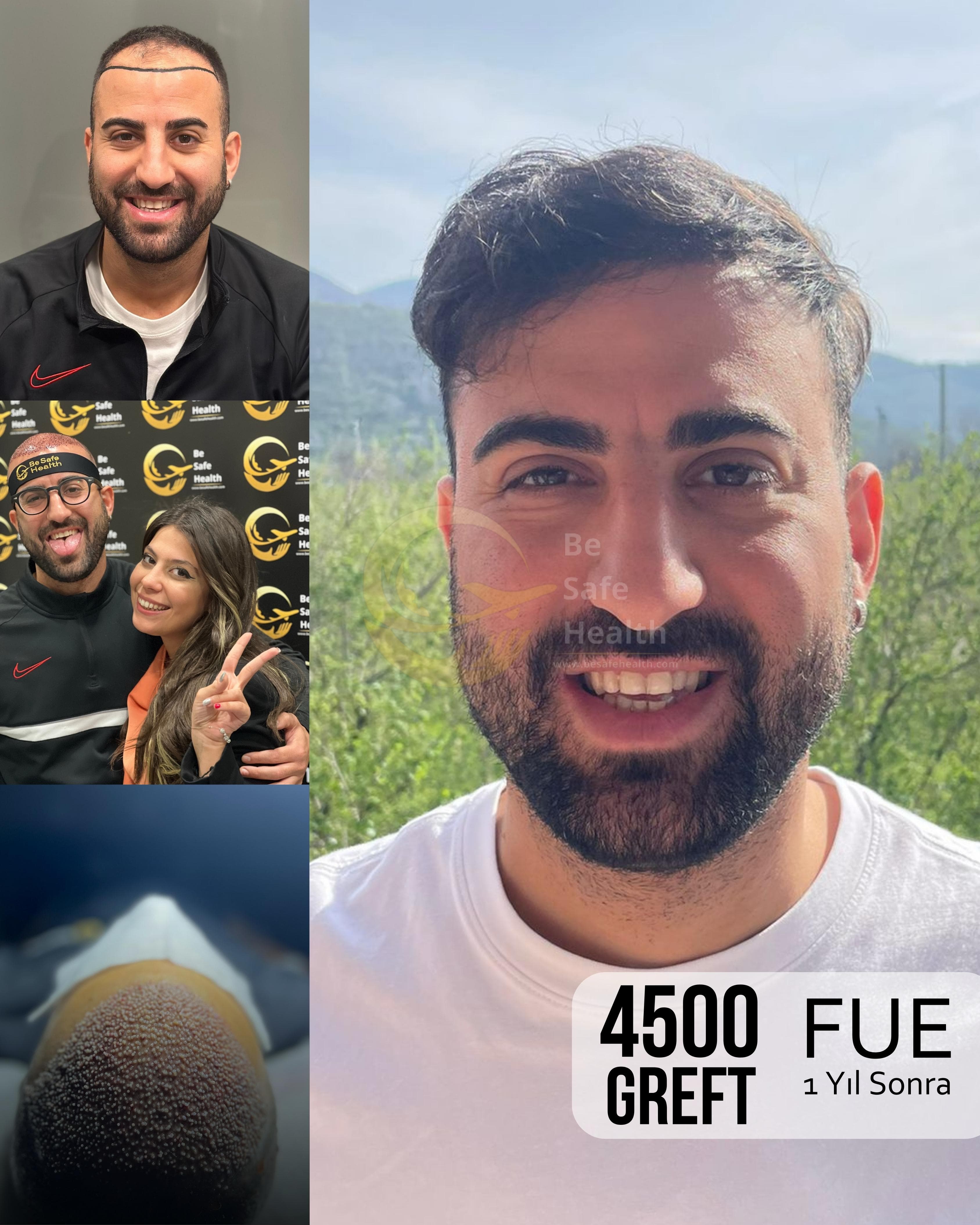 Case 7 - Before & After