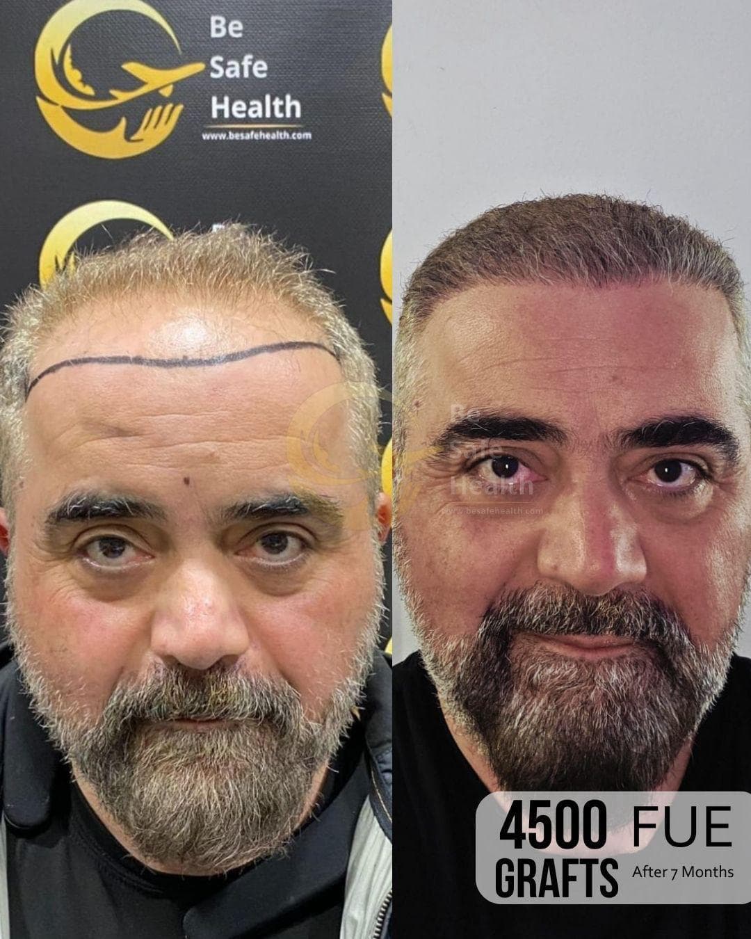 Case 8 - Before & After