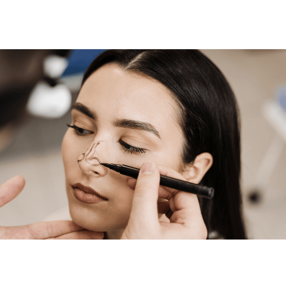 Rhinoplasty