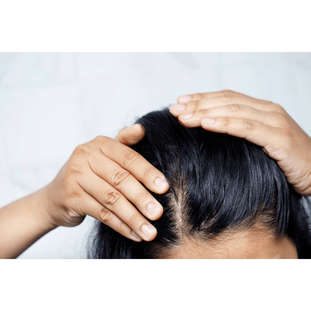 Women's Hair Transplant